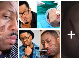 Nollywood Actor Mike Ezuruonye recounts how he escaped ‘permanent blindness’, calls for prayers