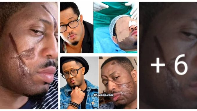 Nollywood Actor Mike Ezuruonye recounts how he escaped ‘permanent blindness’, calls for prayers